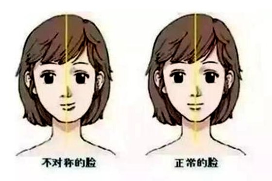 为甚么摆布脸错误称,巨细脸怎样改正