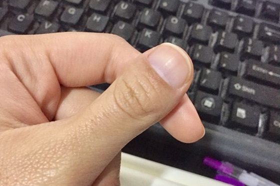 人的大拇指为甚么只要两节,拇指如何只要两个枢纽
