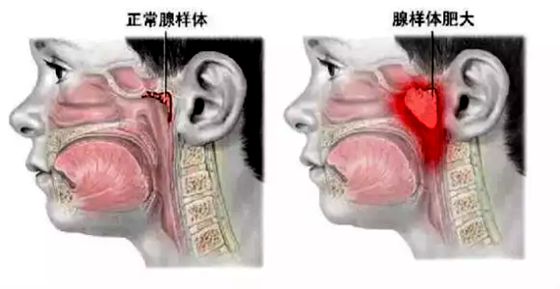 报酬甚么要用鼻子呼吸,用鼻子呼吸的益处