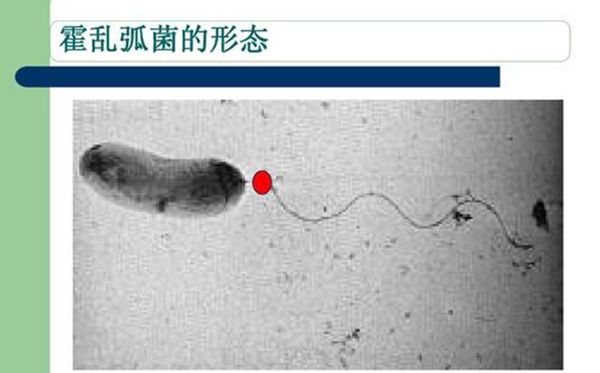 霍乱孤菌的形状