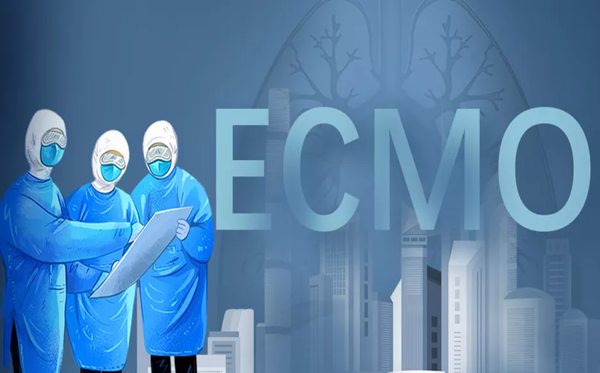 ECMO是甚么意义,ecmo英语怎样读,ecmo为甚么这么贵