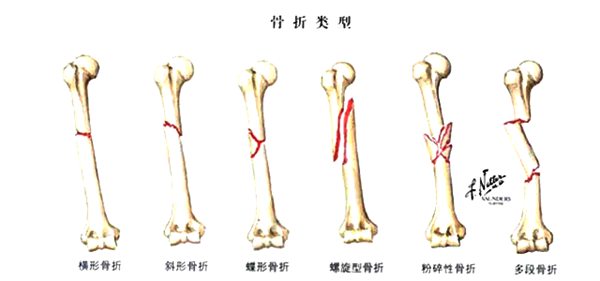 蚂蚁庄园“寒潮橙色预警是甚么品级